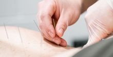 Close up of hands inserting needles during an acupuncture treatment